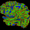 Brain Surface